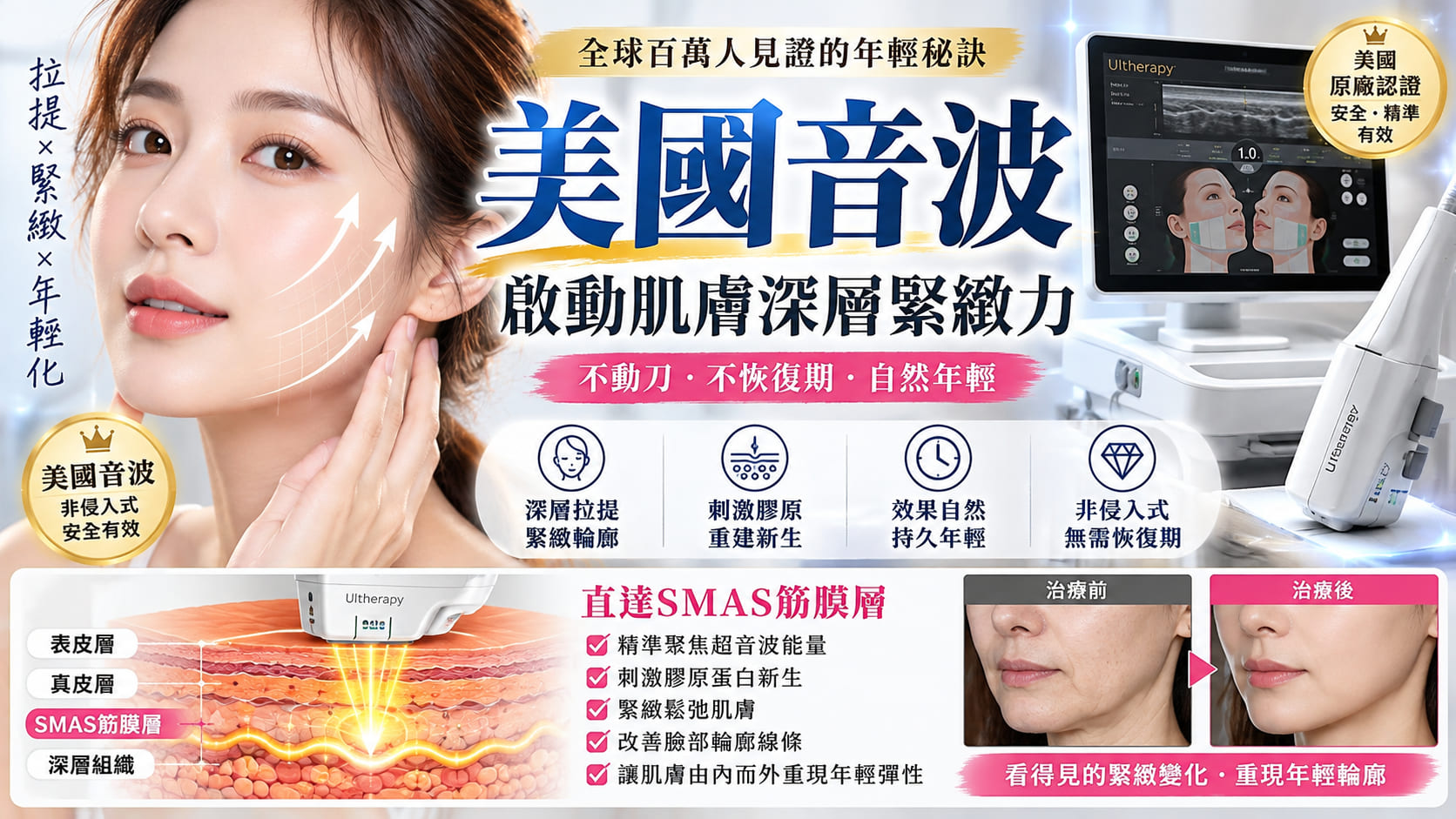 美國音波 vs 鳳凰電波怎麼選?原理、效果、費用、維持時間與適合族群完整比較